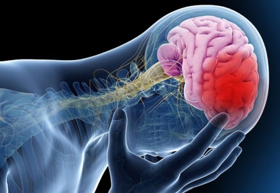 El 99% de infartos y ACV es con factores de riesgo previos