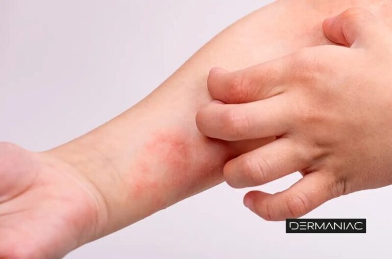 Persona consultando con un médico especialista en dermatitis atópica